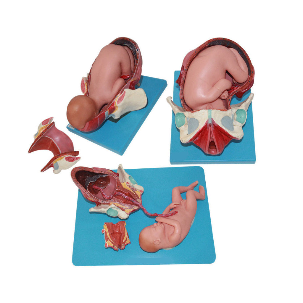Birth Model - Three Stage, 3 Sets - Dr Wong Anatomy