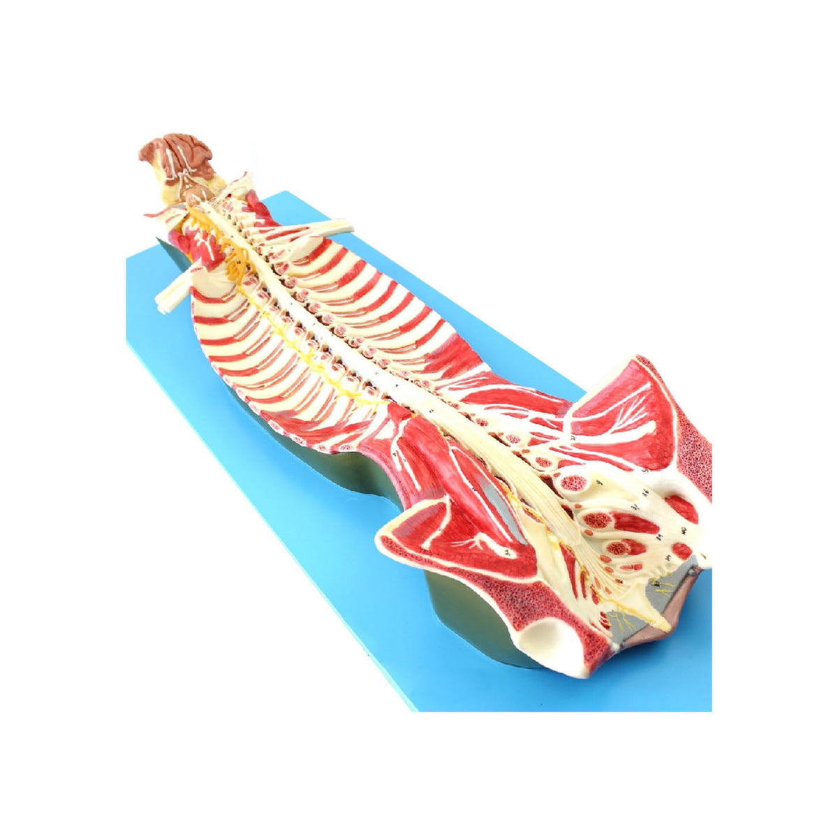 Anatomy Model - Spinal Cord in the Spinal Canal