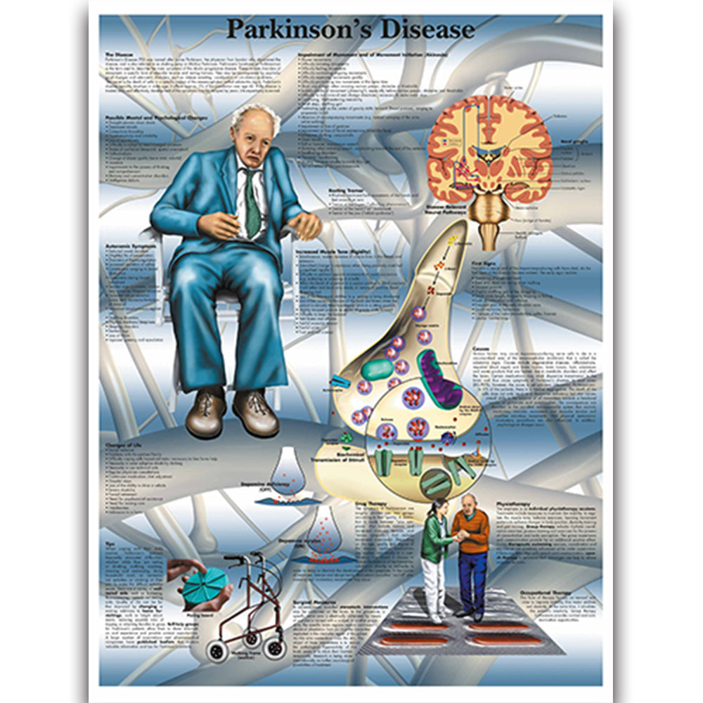 Parkinson's Disease Chart - Dr Wong Anatomy