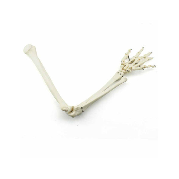 Bones Of The Hand And Forearm - Dr Wong Anatomy