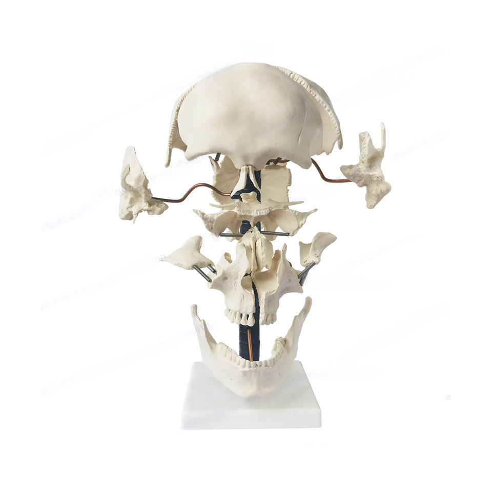 Beauchene Exploded Skull Model