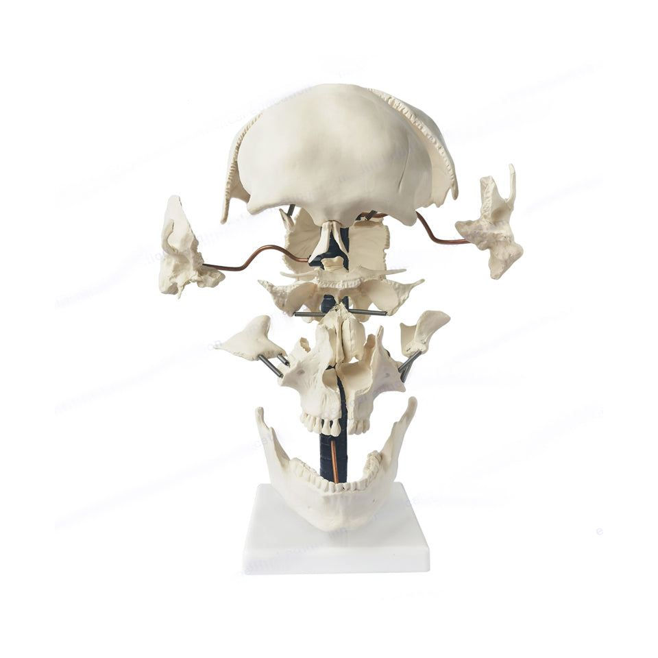 Beauchene Exploded Skull Model – Dr Wong Anatomy