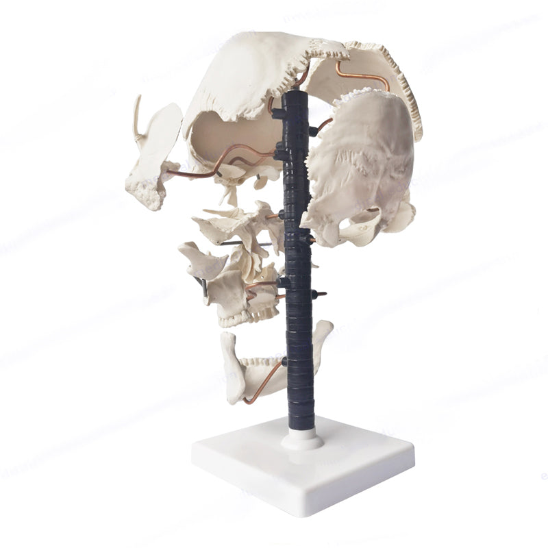 Beauchene Exploded Skull Model – Dr Wong Anatomy