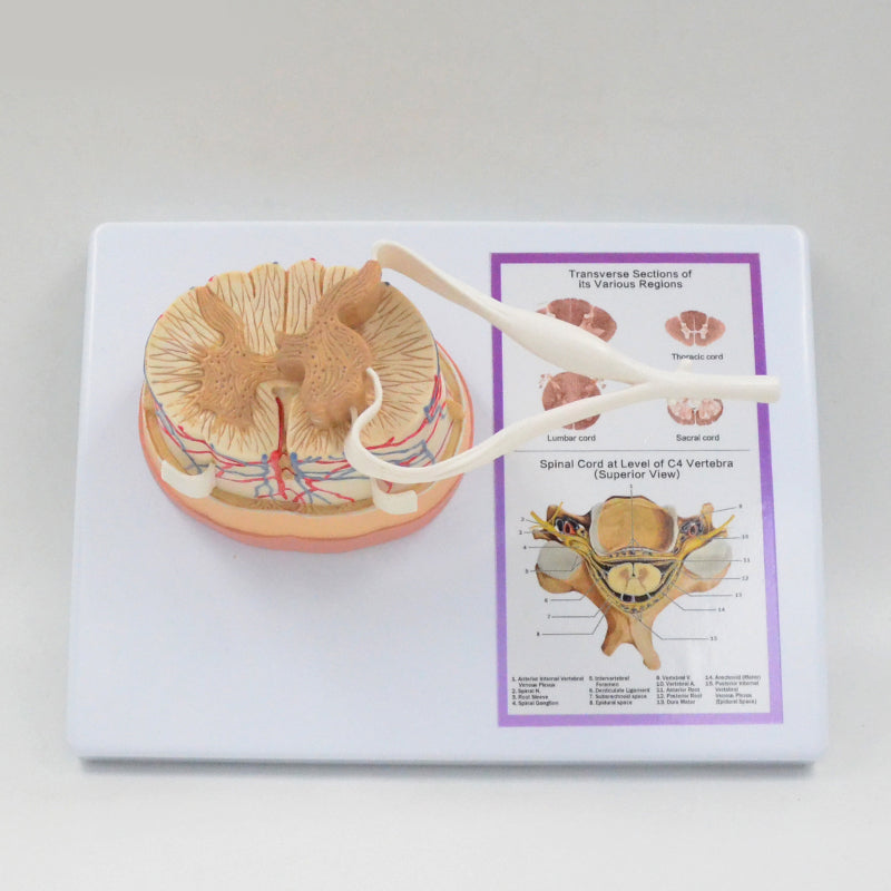 Spinal Cord Anatomy Model – Dr Wong Anatomy