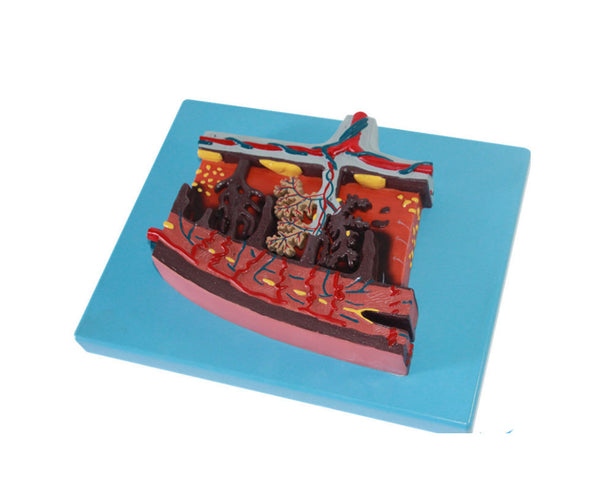 Model of the Placenta, 4X Life-Size - Dr Wong Anatomy