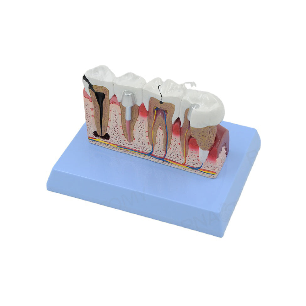 Teeth (oversize) Model - Dr Wong Anatomy