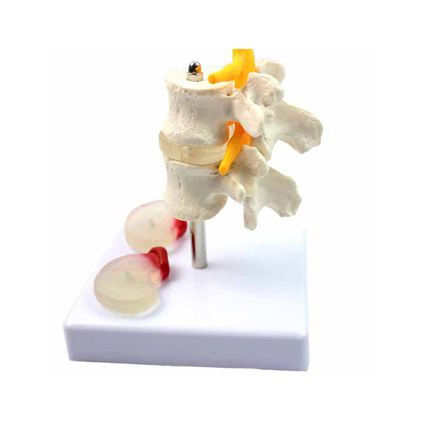 Lumbar Vertebrae With Interchangeable Discs - Dr Wong Anatomy