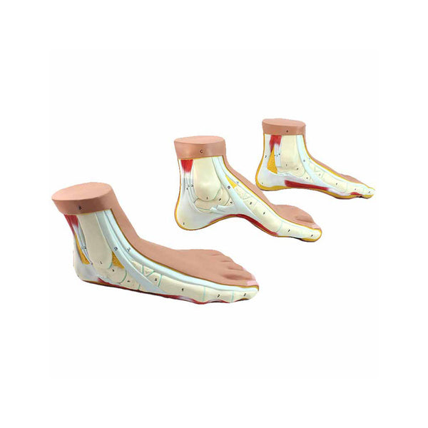 Normal Foot， Flat Foot And High Arched Foot - Dr Wong Anatomy