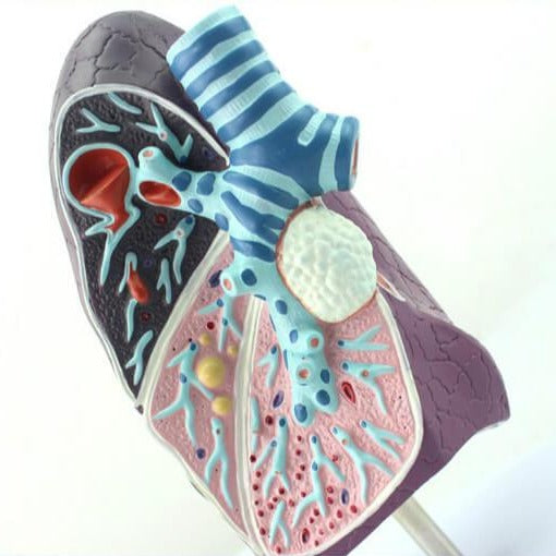Pathological Model of the Lung – Dr Wong Anatomy