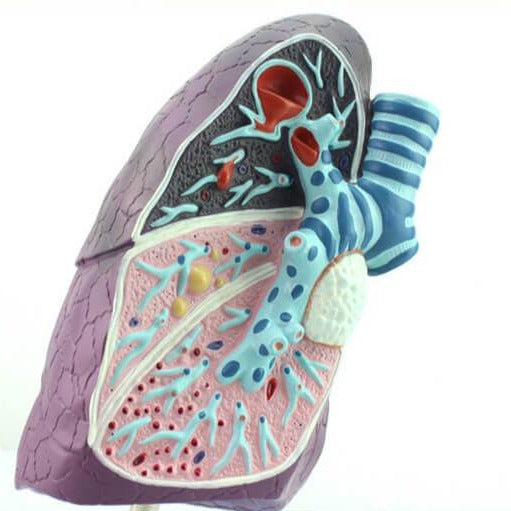 Pathological Model of the Lung – Dr Wong Anatomy