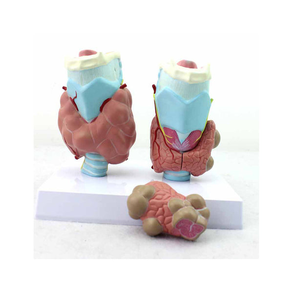 Pathology Of Thyroid Model - Dr Wong Anatomy