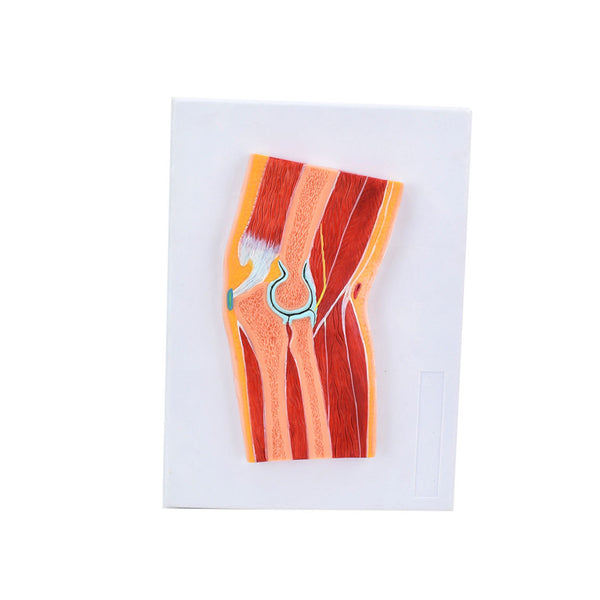 Elbow Joint Section Model, Life-Size - Dr Wong Anatomy