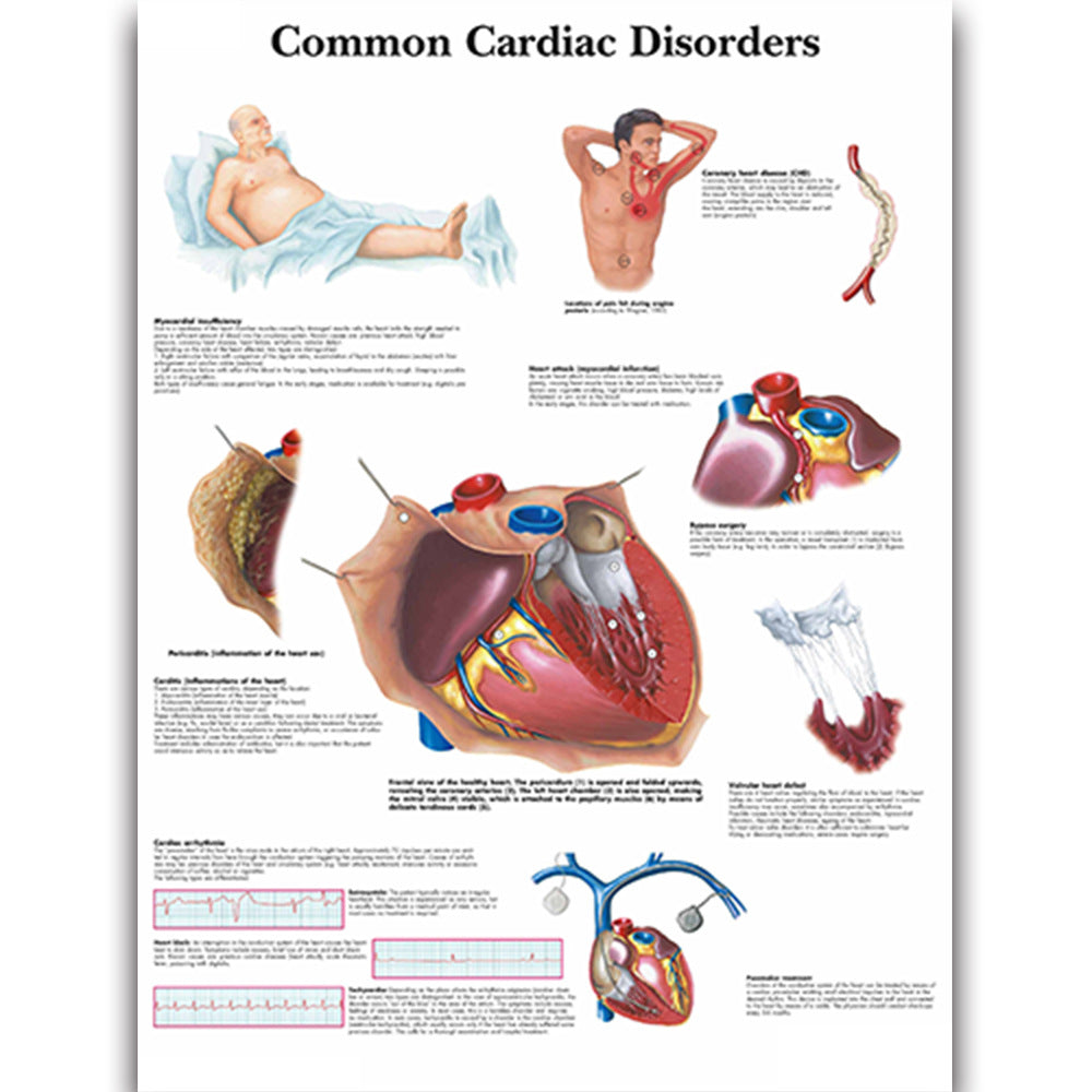 Common Cardiac Disorders disease chart - Dr Wong Anatomy