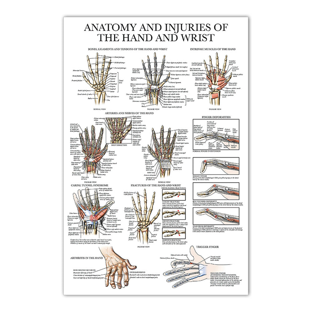 Anatomy and Injuries of the Hand and Wrist Chart - Dr Wong Anatomy