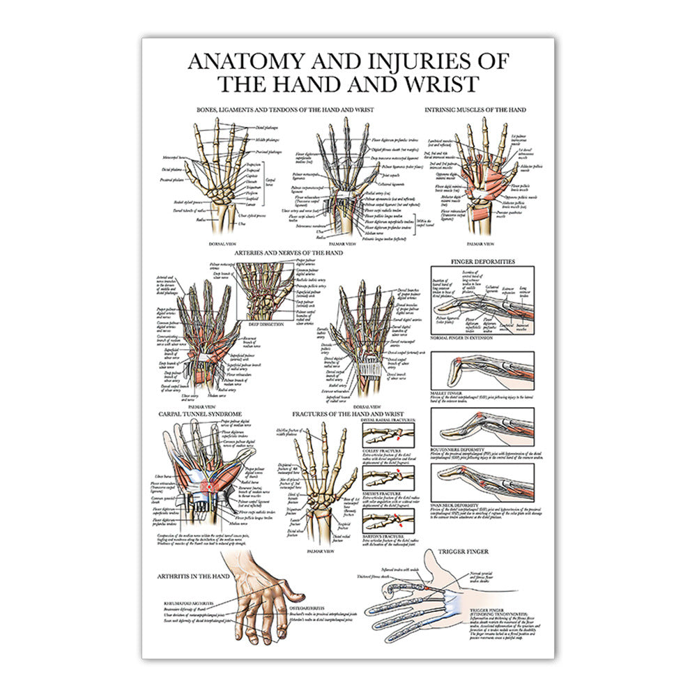 Anatomy Chart - Anatomy and Injuries of the Hand and Wrist