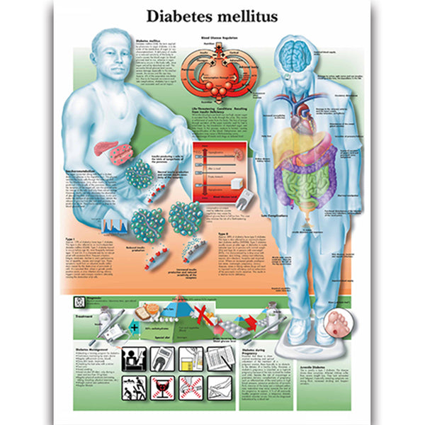 Diabetes Mellitus disease Chart - Dr Wong Anatomy