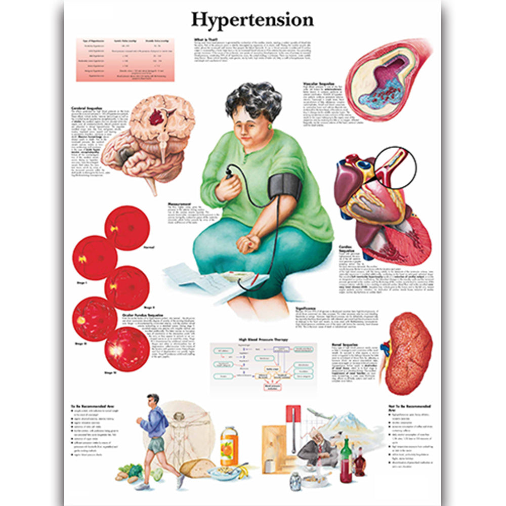 Health Education Chart Hypertension