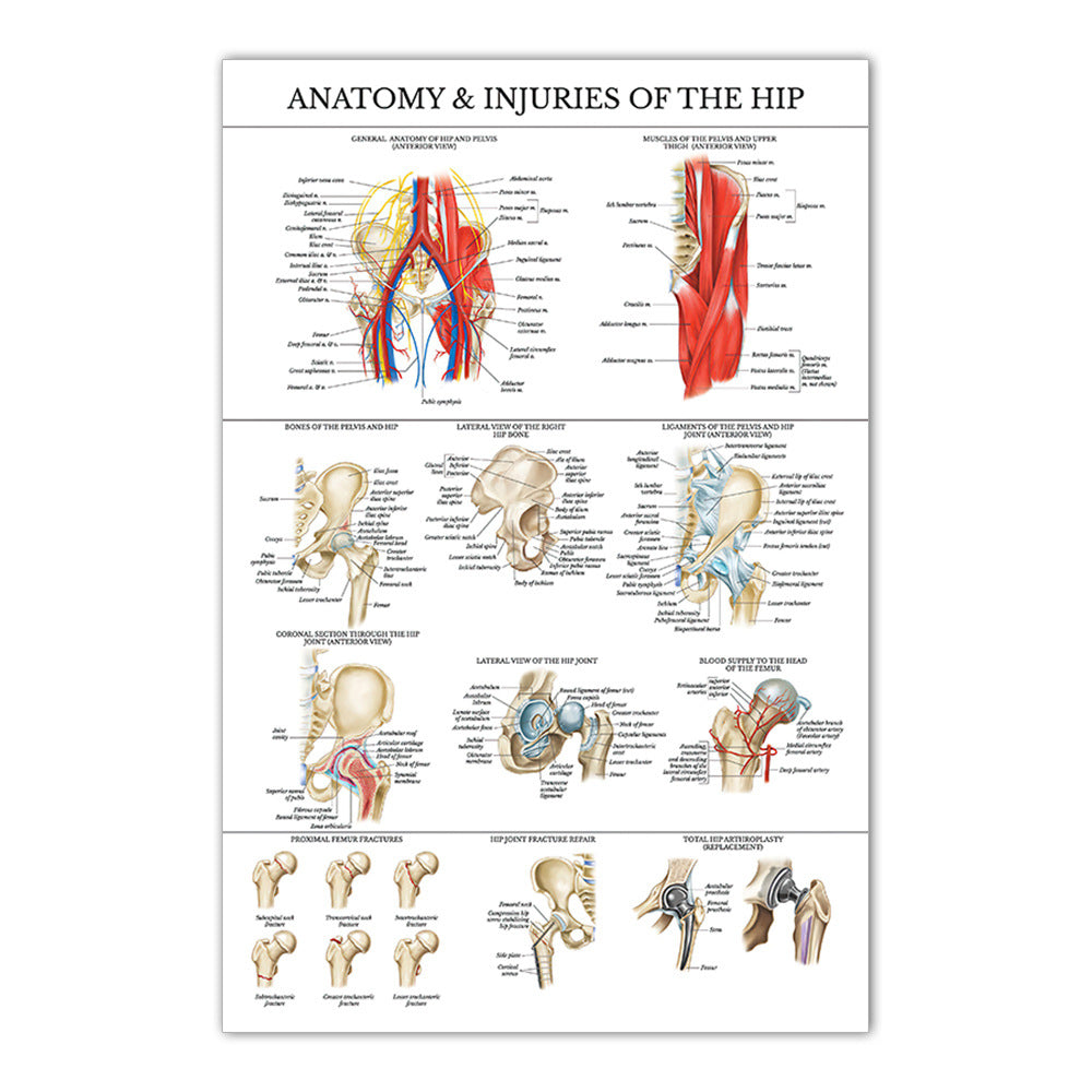 Anatomy & Injuries of the Hip Chart - Dr Wong Anatomy