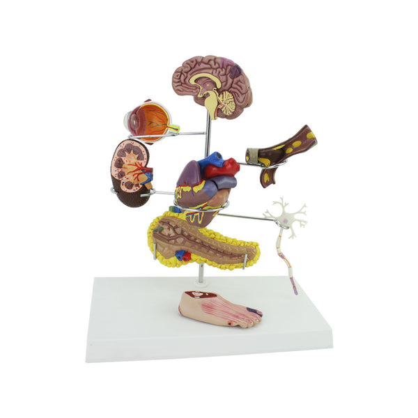 Type II Diabetes Set Model - Dr Wong Anatomy