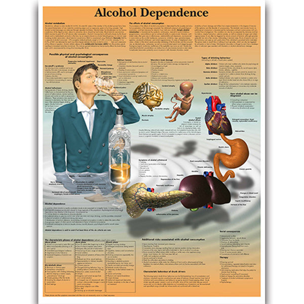 Alcohol Dependence Chart - Dr Wong Anatomy
