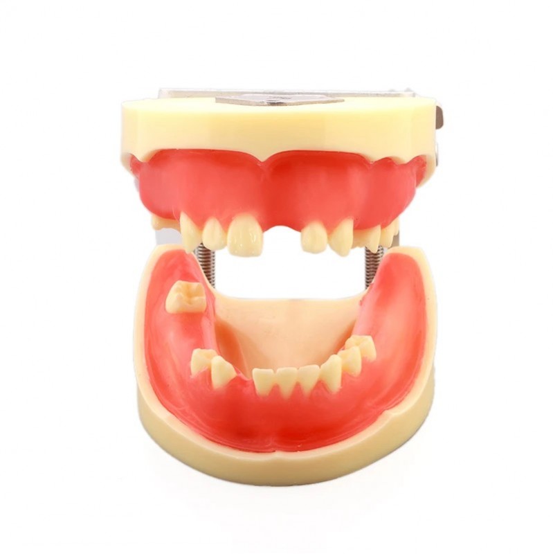 Dental Implant Practice Model with Soft Tissue
