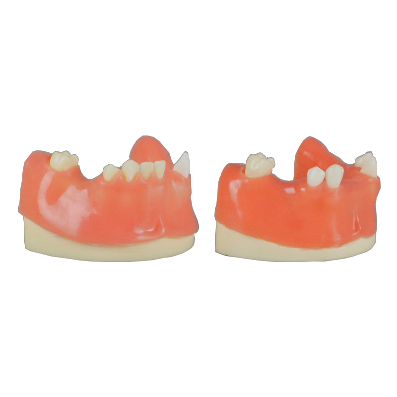Dental Implant Practice Model