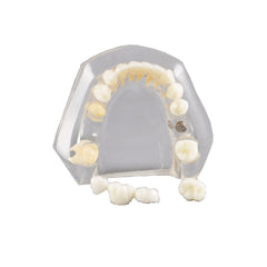  Dental Implant Model Mandibular with Natural Color Teeth