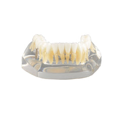  Dental Implant Model Mandibular with Natural Color Teeth