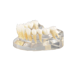  Dental Implant Model Mandibular with Natural Color Teeth