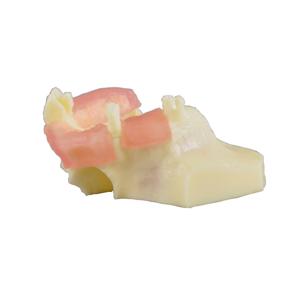Dental Sinus Lift Practice Model Implant Model Resin Material for Sinus Elevation