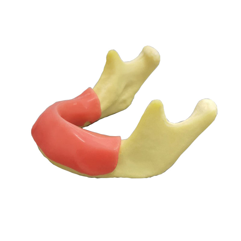 Dental Implant Practice Model Jaw with Soft Gum