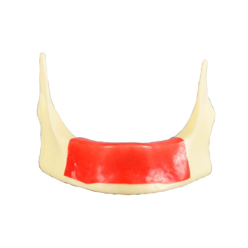 W2025 Implant Practice Model Made of Resin and Cancellous Bone