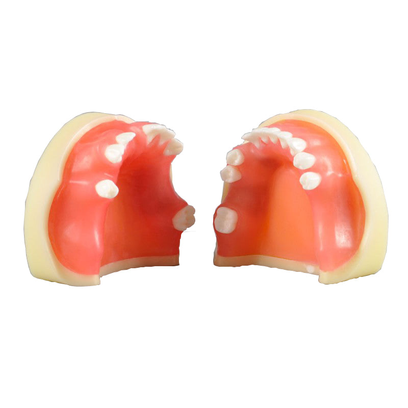 Dental Implant Practice Model Partially Edentulous Model
