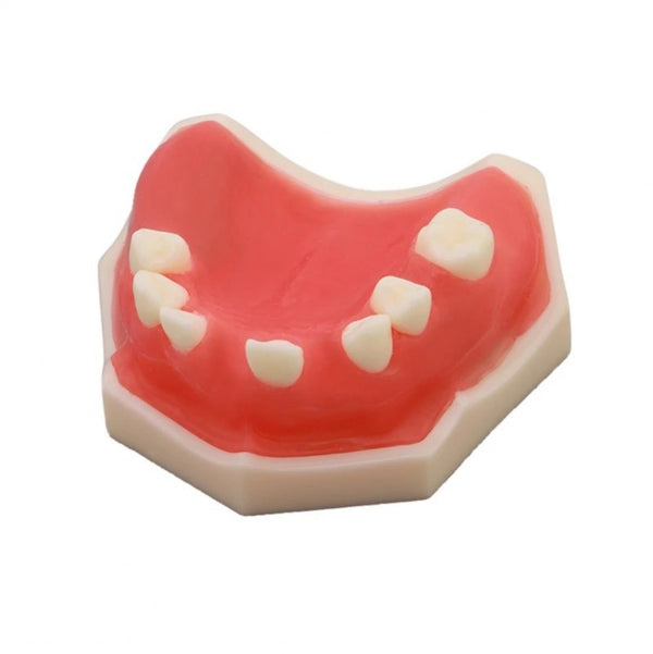 Dental Sinus Lift Practice Model Implant Model