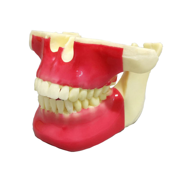 Dental Ortho Implant Practice Model