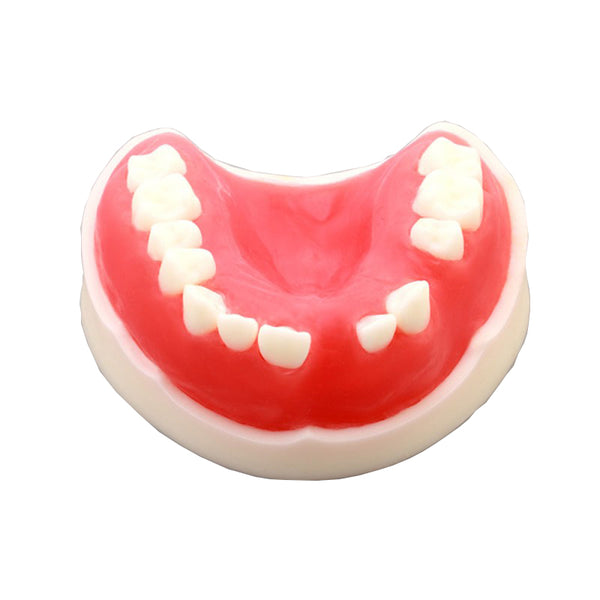 Dental Partially Edentulous Model