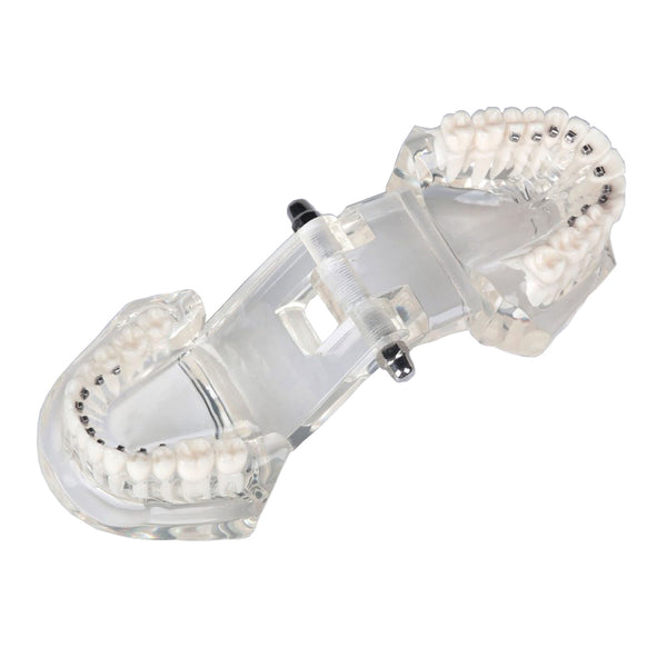 Dental Orthodontic Model with Lingual Bracket