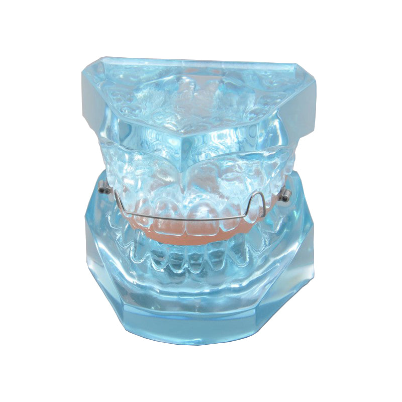 Dental Orthodontic Model with Retainer