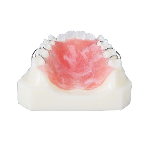 Dental Orthodontic Model with Retainer