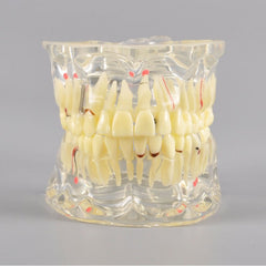 Adult Dental Pathology Model with Different Symptom