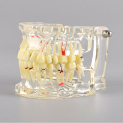 Adult Dental Pathology Model with Different Symptom