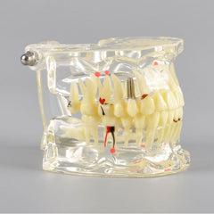 Adult Dental Pathology Model with Different Symptom