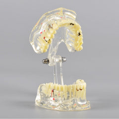 Adult Dental Pathology Model with Different Symptom