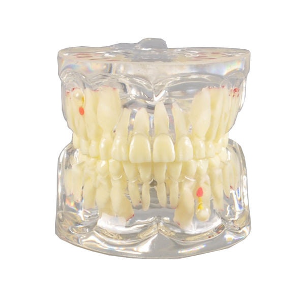 Pediatric Dental Model with Pathology