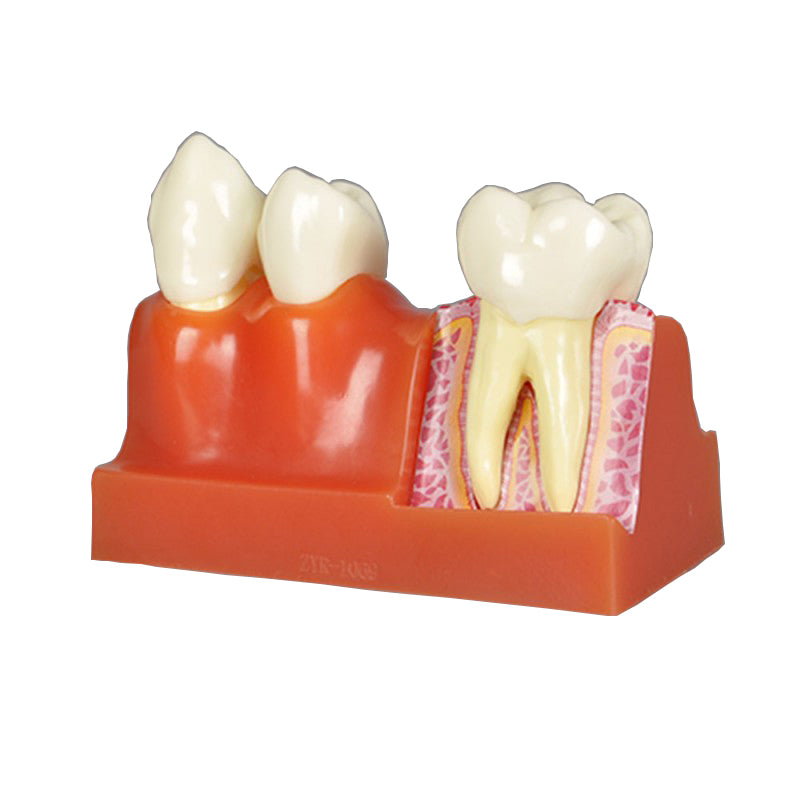 Teeth Anatomy Model, 4X Life-Size