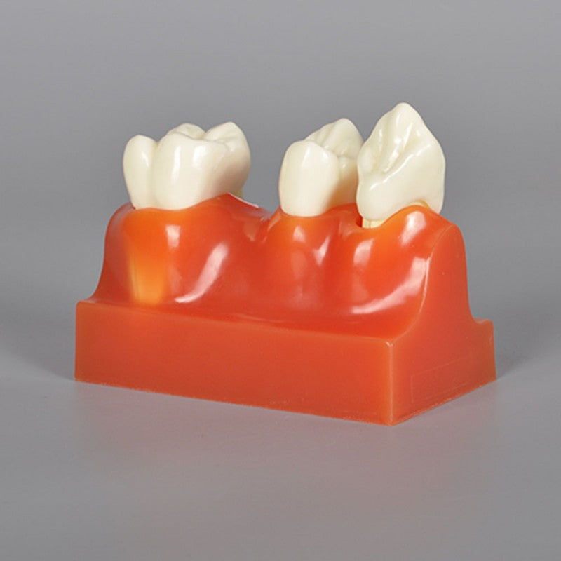 W4016 Teeth Anatomy Model, 4X Life-Size