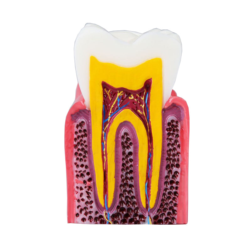 Caries Model Compares Healthy and Caries Tooth