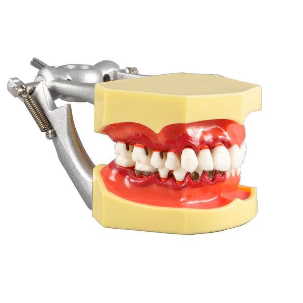 Dental Periodontal Model for Demonstration
