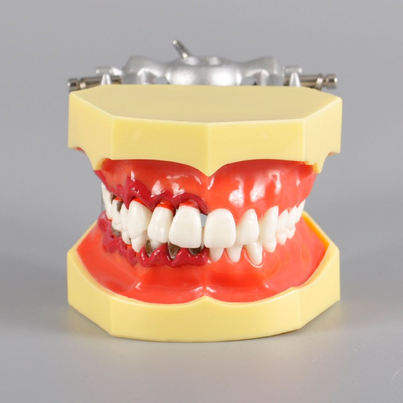 W4025 Dental Periodontal Model for Demonstration