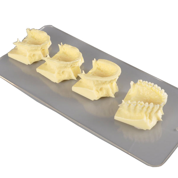 The Development of Upper Jaw